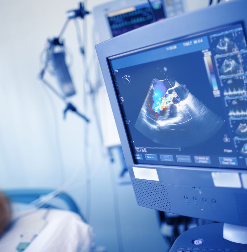 Dobutamine Stress Echo in Nashik